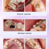 Élimine les cavités, répare les cavités, la plaque aleans, blanchit les dents et rafraîchit l'haleine