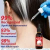 white to black hair serum gʀᴀʏ hᴀɪʀ tʀᴇᴀᴛᴍᴇɴᴛ nᴀᴛᴜʀᴀʟ cᴏʟᴏʀ rᴇᴘᴀɪʀ nᴏᴜʀɪsʜɪɴɢ aɴᴛɪ hᴀɪʀ lᴏss cᴀʀᴇ mᴇɴ wᴏᴍᴇɴ