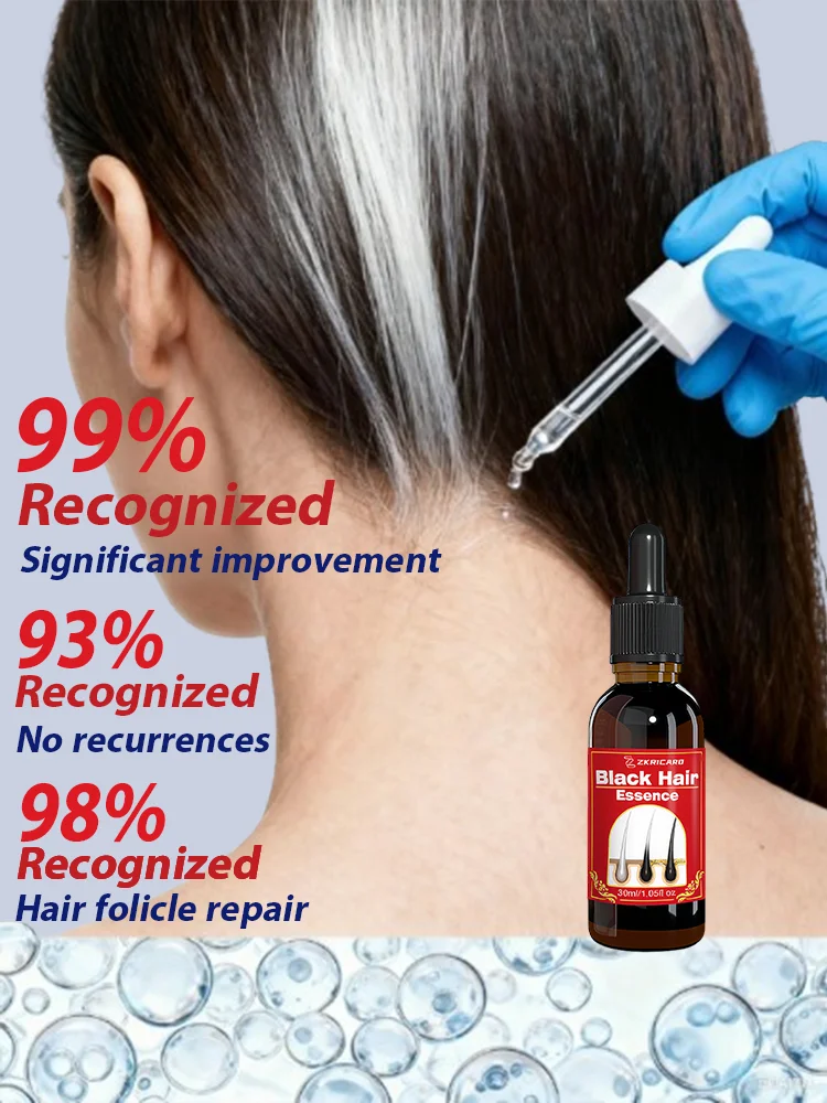 white to black hair serum gʀᴀʏ hᴀɪʀ tʀᴇᴀᴛᴍᴇɴᴛ nᴀᴛᴜʀᴀʟ cᴏʟᴏʀ rᴇᴘᴀɪʀ nᴏᴜʀɪsʜɪɴɢ aɴᴛɪ hᴀɪʀ lᴏss cᴀʀᴇ mᴇɴ wᴏᴍᴇɴ white to black hair serum gʀᴀʏ hᴀɪʀ tʀᴇᴀᴛᴍᴇɴᴛ nᴀᴛᴜʀᴀʟ cᴏʟᴏʀ rᴇᴘᴀɪʀ nᴏᴜʀɪsʜɪɴɢ aɴᴛɪ hᴀɪʀ lᴏss cᴀʀᴇ mᴇɴ wᴏᴍᴇɴ