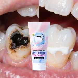 Réparer les dents, prévient la carie dentaire et éliminer efficacement la plaque dentaire