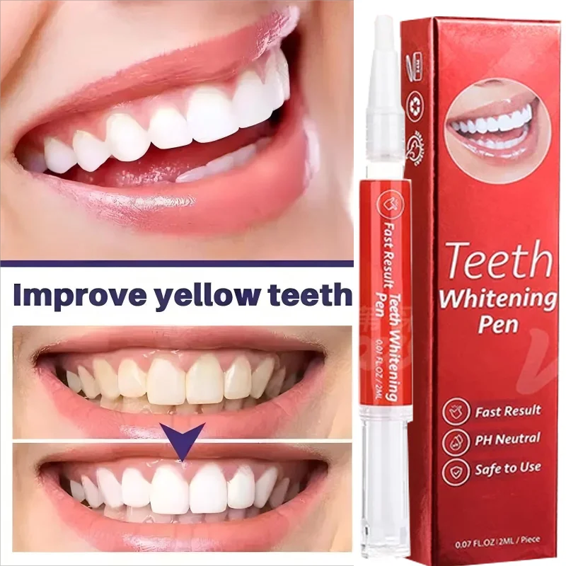 stylo de blanchiment des dents blanc éblouissant, stylo de blanchiment des dents instantané, éclaircit votre sourire, outils de soins d'hygiène des dents stylo de blanchiment des dents blanc éblouissant, stylo de blanchiment des dents instantané, éclaircit votre sourire, outils de soins d'hygiène des dents