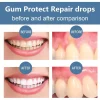 gel de soin réparateur de gencives endommagées, soulage les gencives maléfiques, nettoyage en profondeur des dents, taches, sérum tartre, dentifrice pour caries dentaires