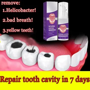 Élimine les cavités, répare les cavités, la plaque Aleans, blanchit les dents et rafraîchit l&rsquo;haleine