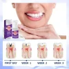 Élimine les cavités, répare les cavités, la plaque aleans, blanchit les dents et rafraîchit l'haleine