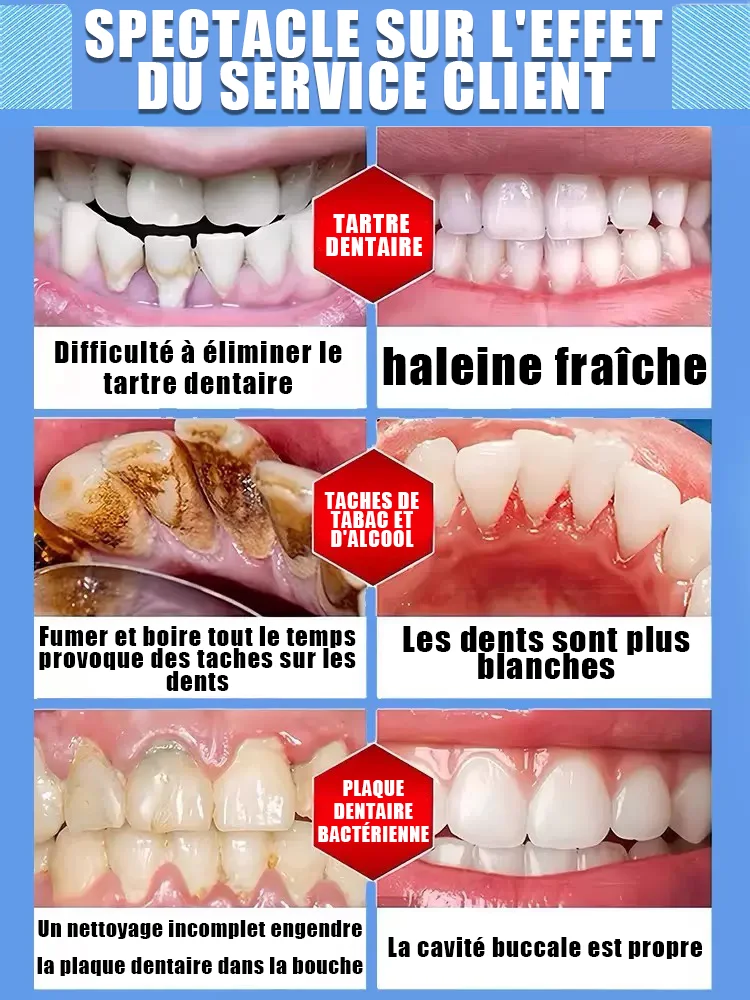 dentifrice blanchissant les dents 5d blanchiment des dents hygiène buccale dentifrice nettoyant haleine fraîche dentifrice dentifrice blanchissant les dents 5d blanchiment des dents hygiène buccale dentifrice nettoyant haleine fraîche dentifrice