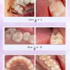 Élimine les cavités, répare les cavités, la plaque aleans, blanchit les dents et rafraîchit l'haleine