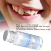perles de remplissage thermique temporaire, réparation des dents, dents cassées et manquantes, blanc, 20g