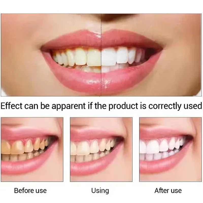 stylo de blanchiment des dents blanc éblouissant, stylo de blanchiment des dents instantané, éclaircit votre sourire, outils de soins d'hygiène des dents stylo de blanchiment des dents blanc éblouissant, stylo de blanchiment des dents instantané, éclaircit votre sourire, outils de soins d'hygiène des dents