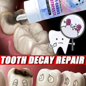 99% personnes Obtenez des dents parfaites |   Entretien et protection