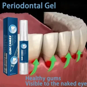 Gel de soin réparateur de gencives endommagées, soulage les gencives maléfiques, nettoyage en profondeur des dents, taches, sérum tartre, caries dentaires T Gel de soin réparateur de gencives endommagées, soulage les gencives maléfiques, nettoyage en profondeur des dents, taches, sérum tartre, caries dentaires T