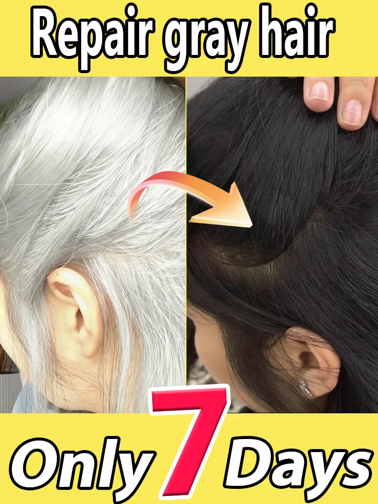 White to Black Hair Serum Gʀᴀʏ Hᴀɪʀ Tʀᴇᴀᴛᴍᴇɴᴛ Nᴀᴛᴜʀᴀʟ Cᴏʟᴏʀ Rᴇᴘᴀɪʀ Nᴏᴜʀɪsʜɪɴɢ Aɴᴛɪ-Hᴀɪʀ Lᴏss Cᴀʀᴇ Mᴇɴ Wᴏᴍᴇɴ White to Black Hair Serum Gʀᴀʏ Hᴀɪʀ Tʀᴇᴀᴛᴍᴇɴᴛ Nᴀᴛᴜʀᴀʟ Cᴏʟᴏʀ Rᴇᴘᴀɪʀ Nᴏᴜʀɪsʜɪɴɢ Aɴᴛɪ-Hᴀɪʀ Lᴏss Cᴀʀᴇ Mᴇɴ Wᴏᴍᴇɴ