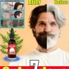 White to Black Hair Serum Gʀᴀʏ Hᴀɪʀ Tʀᴇᴀᴛᴍᴇɴᴛ Nᴀᴛᴜʀᴀʟ Cᴏʟᴏʀ Rᴇᴘᴀɪʀ Nᴏᴜʀɪsʜɪɴɢ Aɴᴛɪ-Hᴀɪʀ Lᴏss Cᴀʀᴇ Mᴇɴ Wᴏᴍᴇɴ