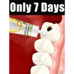 Contient les probiotiques pour réparer la carie dentaire et nettoyer les dents Contient les probiotiques pour réparer la carie dentaire et nettoyer les dents