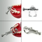 Séparateur de dents dentaires, séparateur de dents, cales de retenue, dents antérieures, Instrument orthodontique, matrice, barrage en caoutchouc