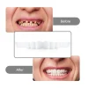 2 paires de prothèses dentaires, soins dentaires temporaires, couverture supérieure de faux dents, snap