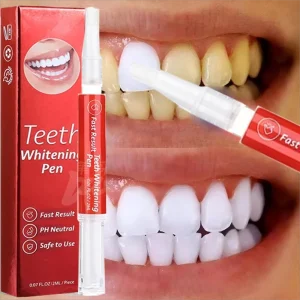 Stylo de blanchiment des dents blanc éblouissant, stylo de blanchiment des dents instantané, éclaircit votre sourire, outils de soins d’hygiène des dents Stylo de blanchiment des dents blanc éblouissant, stylo de blanchiment des dents instantané, éclaircit votre sourire, outils de soins d’hygiène des dents