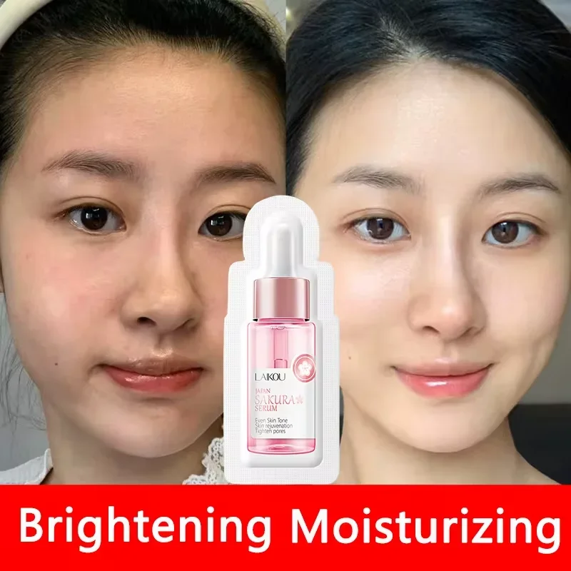 sakura – sérum blanchissant pour le visage, anti âge, estompe les ridules, resserre les pores, améliore le pigment de mélanine, hydratant terne, éclaircissant, soins pour la peau sakura – sérum blanchissant pour le visage, anti âge, estompe les ridules, resserre les pores, améliore le pigment de mélanine, hydratant terne, éclaircissant, soins pour la peau