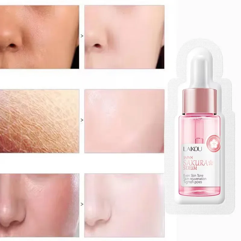 sakura – sérum blanchissant pour le visage, anti âge, estompe les ridules, resserre les pores, améliore le pigment de mélanine, hydratant terne, éclaircissant, soins pour la peau sakura – sérum blanchissant pour le visage, anti âge, estompe les ridules, resserre les pores, améliore le pigment de mélanine, hydratant terne, éclaircissant, soins pour la peau