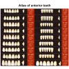 vvdental a1 a2 a3 dentaire résine synthétique dents prothèse dents supérieur antérieur inférieur dentier dents modèle d'éducation dentaire