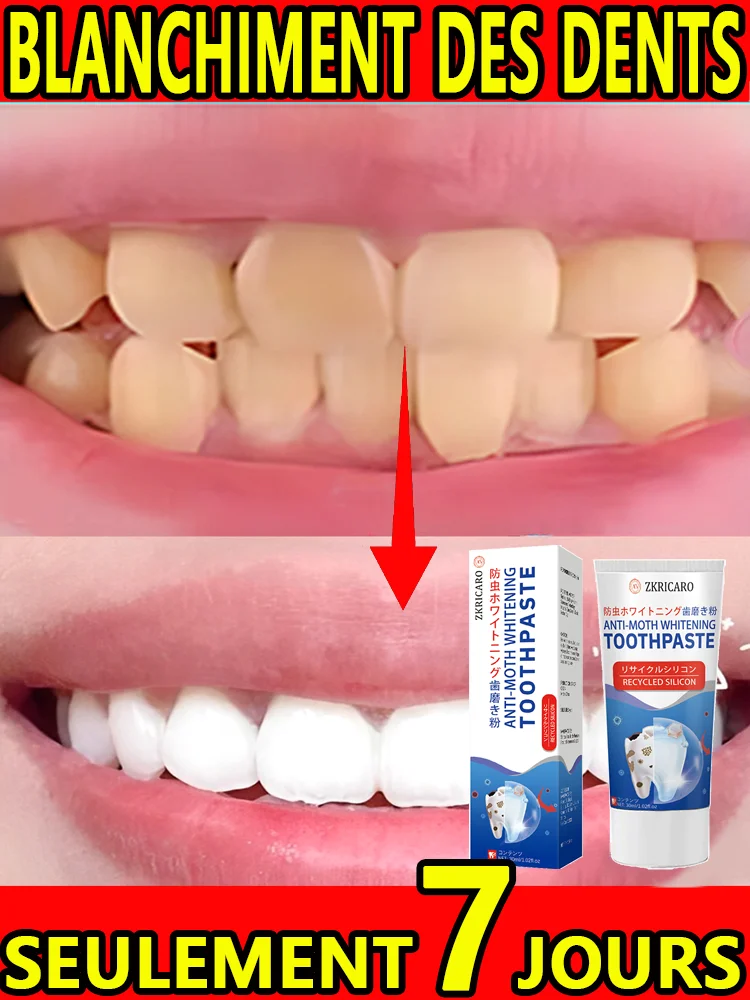 Dentifrice blanchissant les dents 5D blanchiment des dents hygiène buccale dentifrice nettoyant haleine fraîche dentifrice Dentifrice blanchissant les dents 5D blanchiment des dents hygiène buccale dentifrice nettoyant haleine fraîche dentifrice