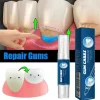 Gel de soin réparateur de gencives endommagées, soulage les gencives maléfiques, nettoyage en profondeur des dents, taches, sérum tartre, dentifrice pour caries dentaires