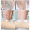 sakura crème d'épilation rapide indolore inhibiteur de croissance des cheveux bras aisselles jambes zones intimes dépilatoire permanent pour hommes femme