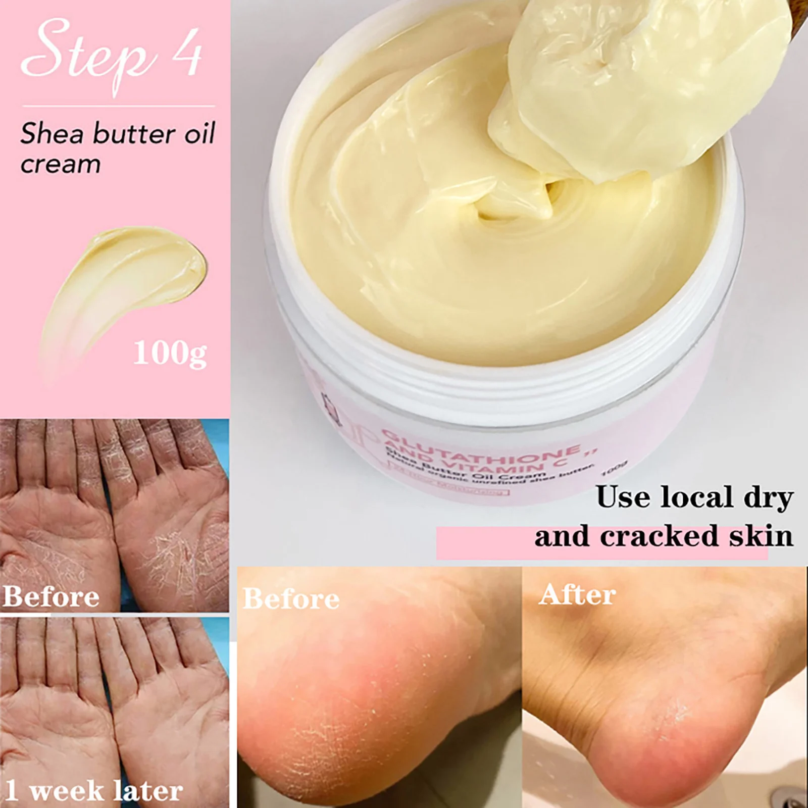 ailke ensemble blanchissant au glutathion et à la vitamine c, hydratant, peau lisse, réduit les taches foncées, hydratation, même le teint ailke ensemble blanchissant au glutathion et à la vitamine c, hydratant, peau lisse, réduit les taches foncées, hydratation, même le teint