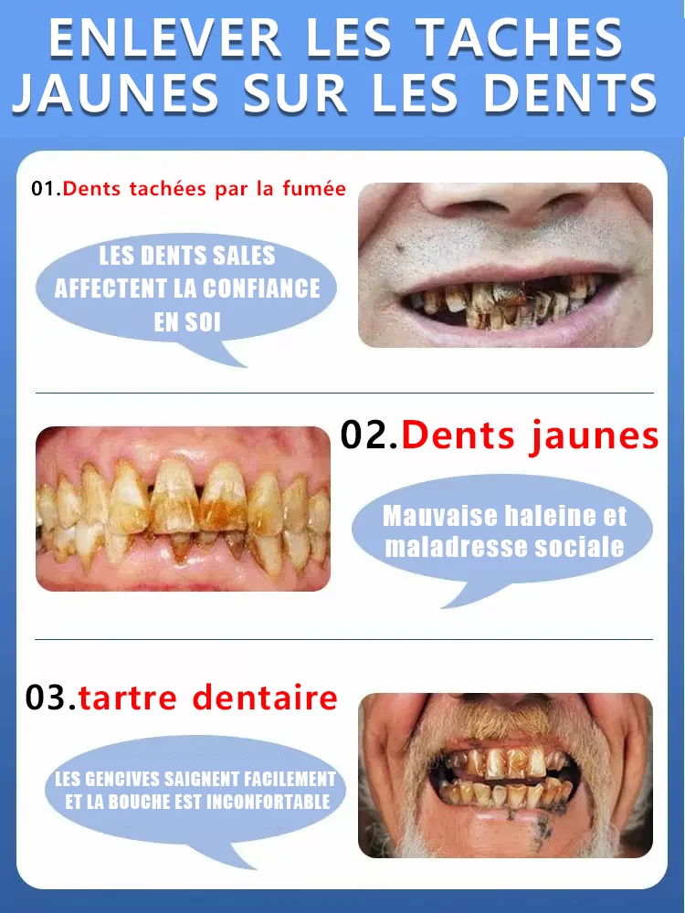 dentifrice blanchissant les dents 5d blanchiment des dents hygiène buccale dentifrice nettoyant haleine fraîche dentifrice dentifrice blanchissant les dents 5d blanchiment des dents hygiène buccale dentifrice nettoyant haleine fraîche dentifrice